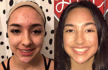 Load image into Gallery viewer, LumiSpa + Nutricentials Premium