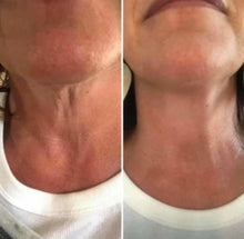 Load image into Gallery viewer, ageLOC® Dermatic Effects