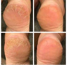 Load image into Gallery viewer, Epoch® Sole Solution® Foot Treatment