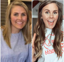 Load image into Gallery viewer, Scalp & Hair System Kit