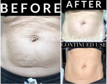 Load image into Gallery viewer, ageLOC® Dermatic Effects